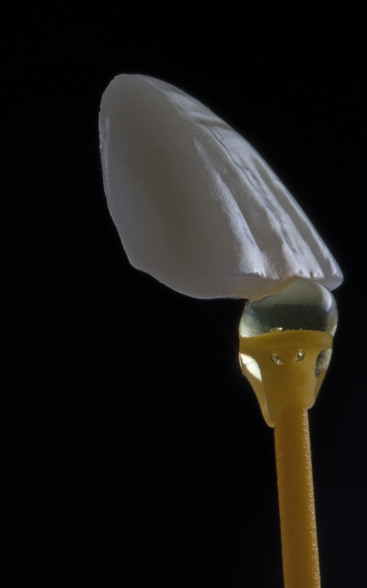 https://akyolmedical.com.tr/wp-content/uploads/2022/09/Porcelain-Veneers.png