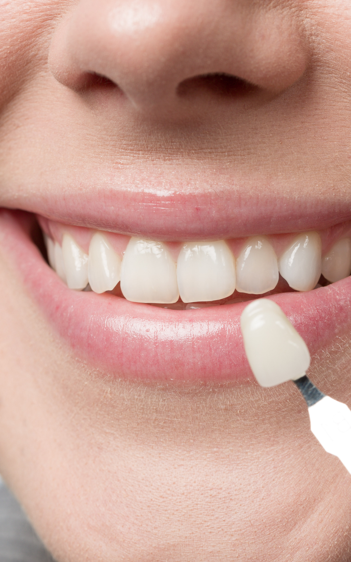 https://akyolmedical.com.tr/wp-content/uploads/2022/09/Zirconium-Crowns.png